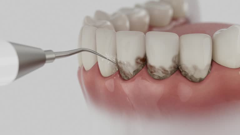 Reliable Dental contractor in Bradner, OH by Dentist Open Now
